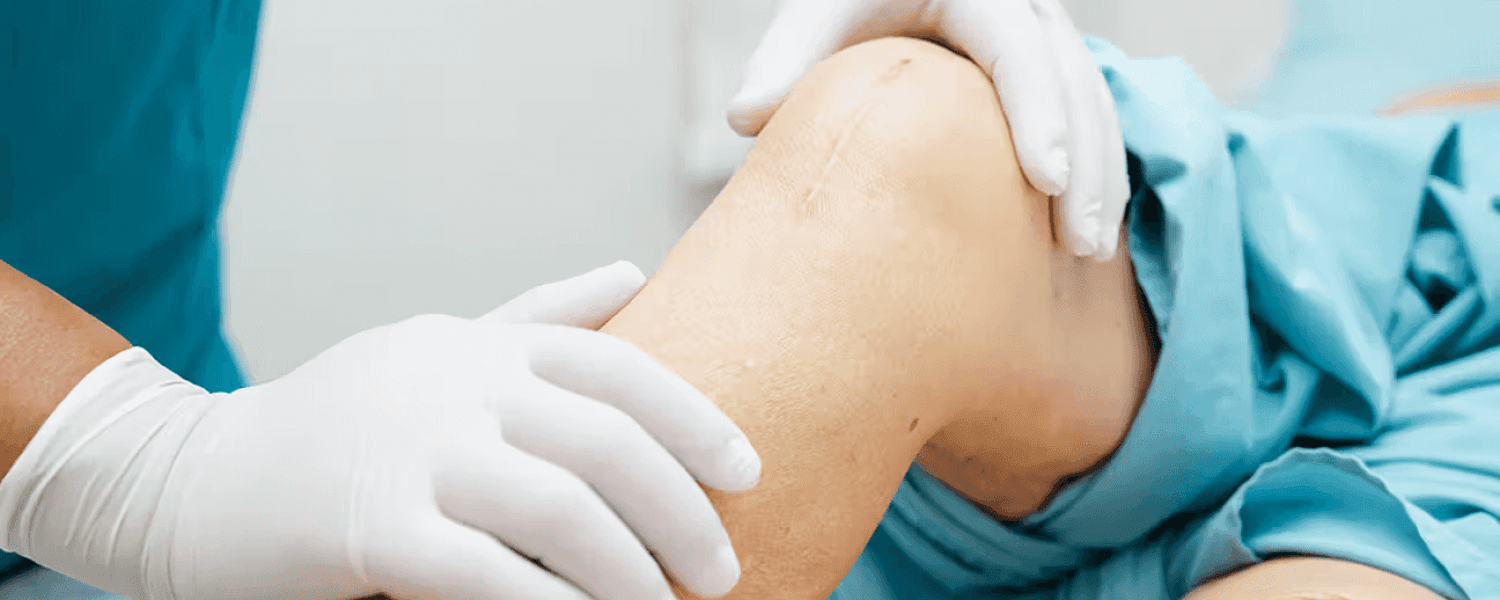 Knee arthroscopy and sports injury treatment by Dr. Uday Prakash Reddy
