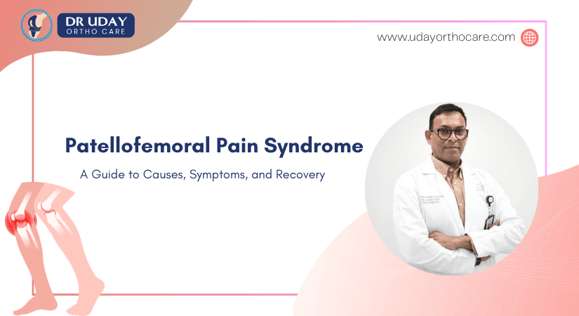 Patellofemoral Pain Syndrome: Understanding and Managing Runner's Knee